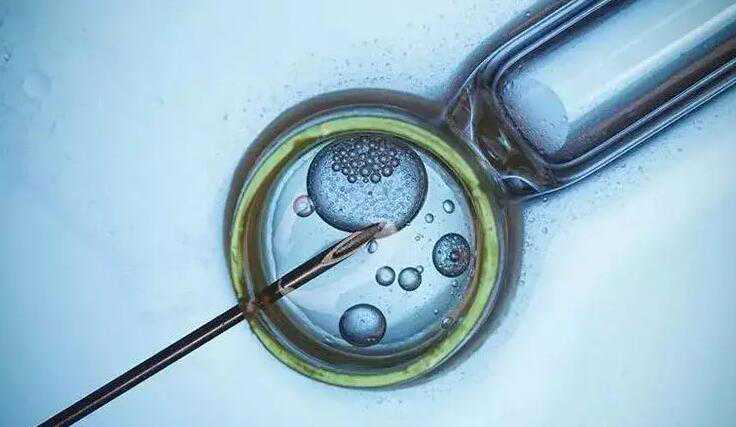 精子质量差怎么办_男染色体异常试管|义乌疾病防控中心试管婴儿同自然妊娠孩